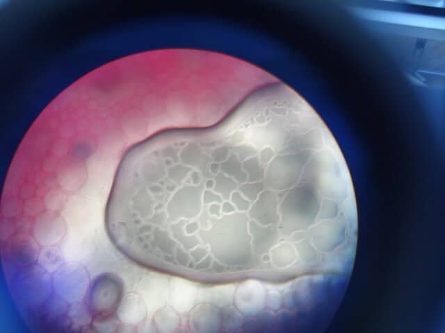 célula apoptose 
