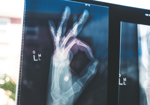 raio X tecido ósseo